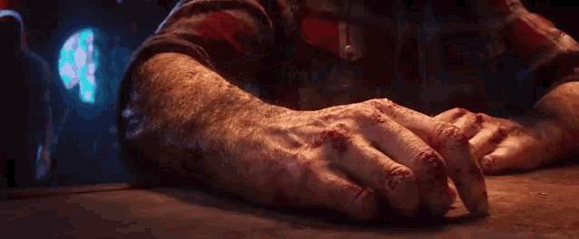 a close up of a man 's bloody hands sitting on a table .