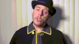 a man wearing a hat and a coat has a black eye .