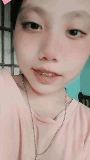 a girl with braces on her teeth is wearing a pink shirt and a silver chain necklace