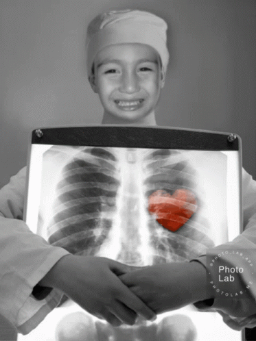 Heart Xray GIF - Heart Xray Beating GIFs