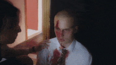 a man with blood on his face is being comforted by another person