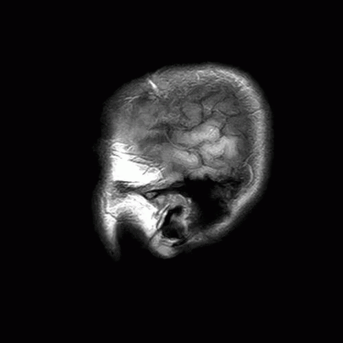 Brain Scan GIF - Brain Scan GIFs