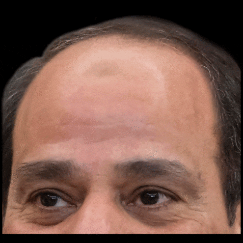 a close up of a man 's forehead with his eyes visible
