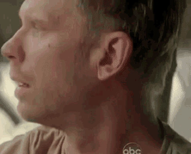 a close up of a man 's neck and ear with a bruise on it .