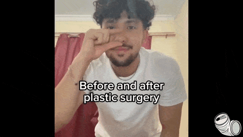 a man in a white shirt is making a funny face with the words before and after plastic surgery written below him .