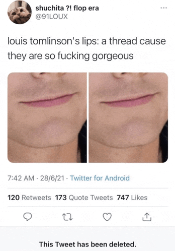 a louis tomlinson 's lips tweet has been deleted