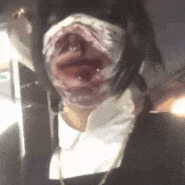 a person with a bandage on their face is making a funny face .