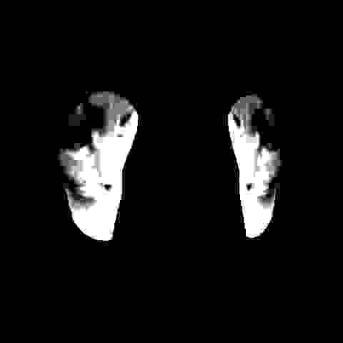 a black and white photo of a person 's face in a dark room .