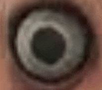 a close up of a person 's eye with a black circle in the middle