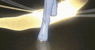 a close up of a person 's leg with a light behind it .