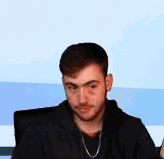 a man with a black eye is wearing a black hoodie and a chain .