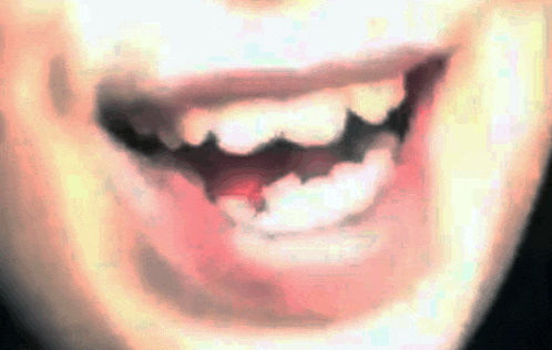 a close up of a person 's mouth with their teeth visible