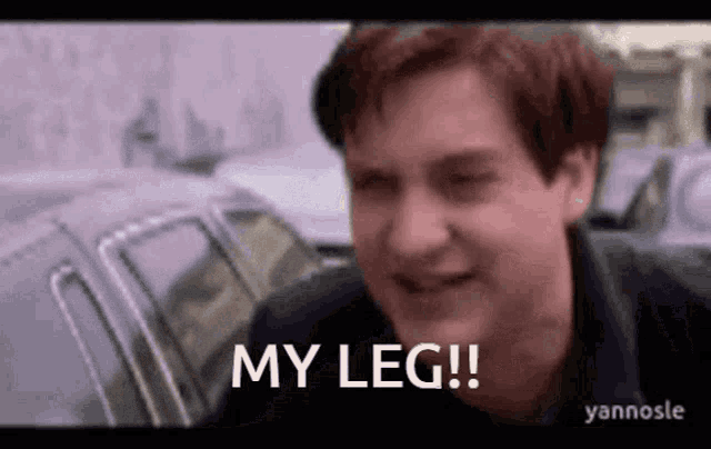 a man is standing in front of a car and says `` my leg ! ''