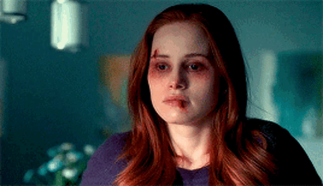 a woman with a bruise on her face is looking at the camera .