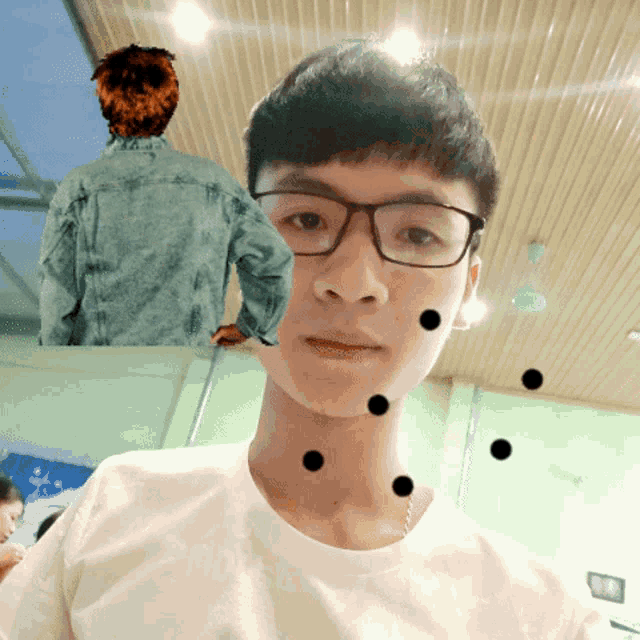 a young man wearing glasses and a white shirt has black spots on his face