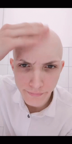 Head Bald GIF - Head Bald Scratch GIFs