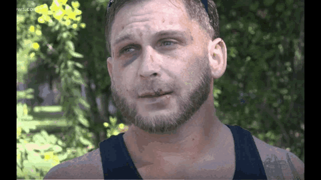a man with a beard has a black eye and a black tank top