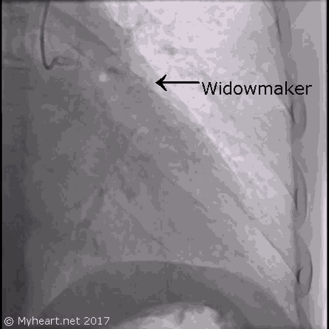 Widow Maker GIF - Widow Maker Heart GIFs