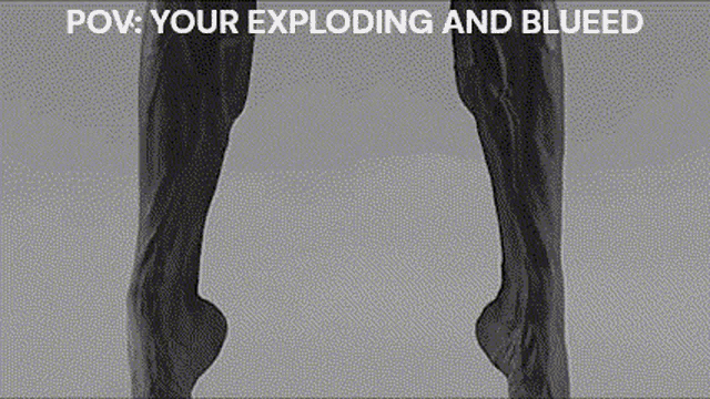 a black and white photo of a person 's legs with the caption " your exploding and blueed " on the bottom