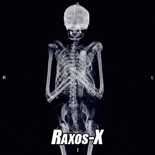 Radiografía GIF - Rafiografia Rayos X Esqueleto GIFs