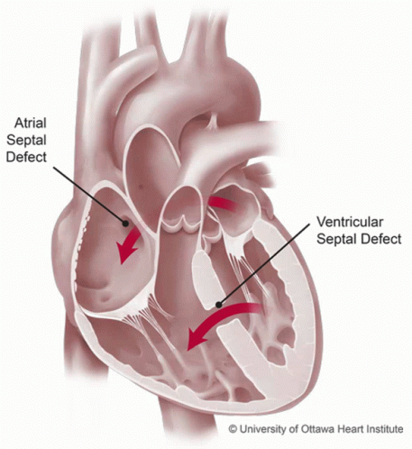 Holeheart Heart GIF - Holeheart Heart Hole GIFs