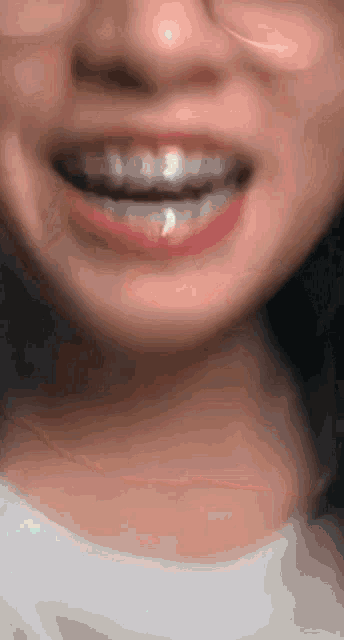 a close up of a woman 's mouth with braces and glasses