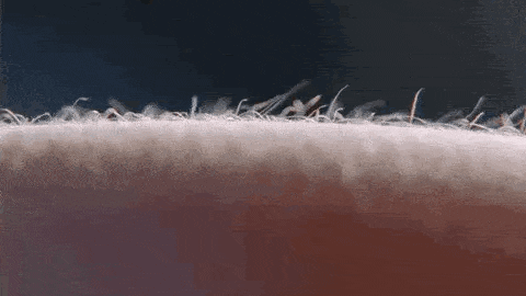 a close up of a person 's arm with a lot of hair on it .