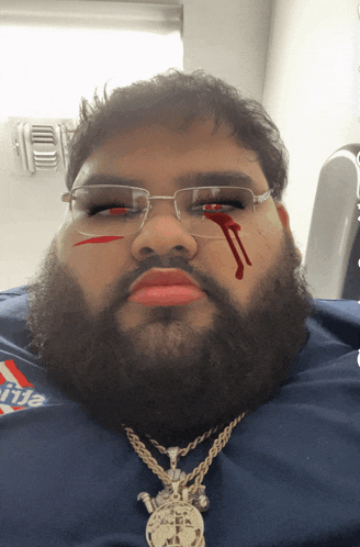 a man with a beard wearing glasses and a necklace has blood on his eye