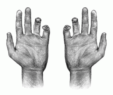 Hands Dying GIF - Hands Dying Skeleton GIFs