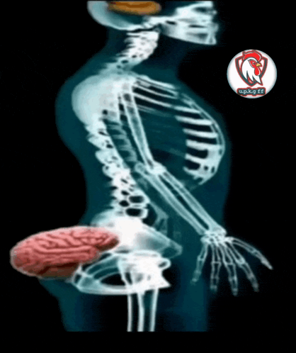 an x-ray of a skeleton with a chicken on it