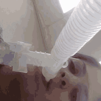 a woman is wearing an oxygen mask in a hospital room .