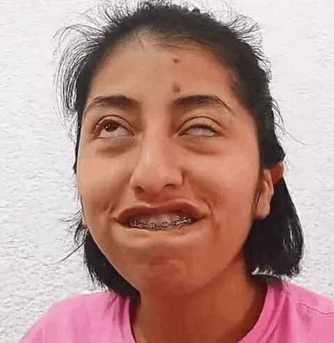 a woman with braces on her teeth is making a funny face while wearing a pink shirt .