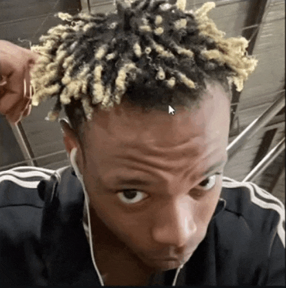 a close up of a person 's head with a white arrow pointing to his hair