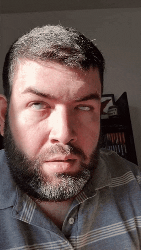 a man with a beard wearing a striped shirt is making a funny face