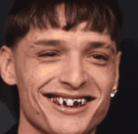 a close up of a man 's face with a smile on his face and a missing tooth .