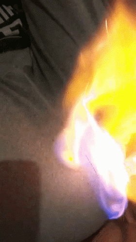 Fire Fart Burning GIF - Fire Fart Burning Chemical GIFs