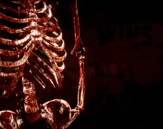 the terminator wins flawless victory with a bloody skeleton holding a gun .