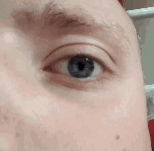 a close up of a woman 's blue eye with a few spots on it