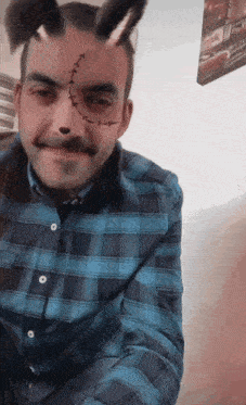 a man wearing a plaid shirt has stitches on his forehead