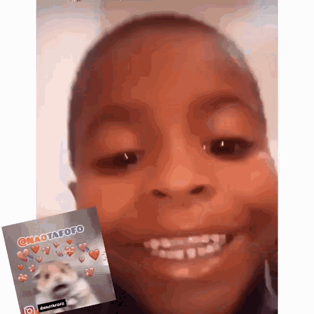 a child with braces is smiling next to a picture of a dog with hearts on it