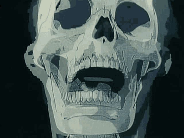an x-ray of a skull with a mouth open