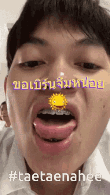 a young man with braces on his teeth is making a funny face with #taetaenahee written below him