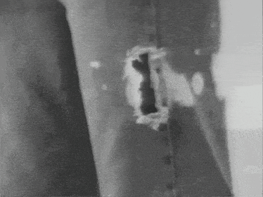 a black and white photo of a person 's pants with a hole in them .