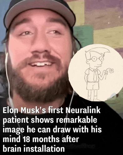 elon musk 's first neuralink patient shows remarkable image he can draw with his mind 18 months after brain installation ..