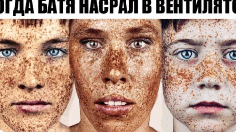 three people with freckles on their faces are shown with a caption in russian