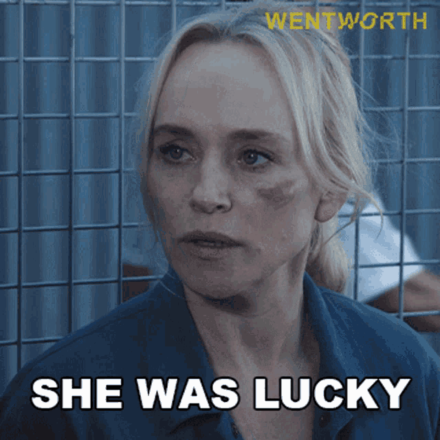 a woman with a black eye is behind a fence with the caption she was lucky