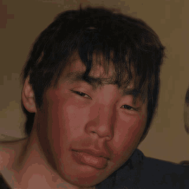 a close up of a man 's face with a red spot on his cheek