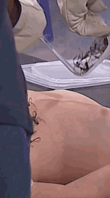 a person is laying on a table with a tray of spiders on their back .