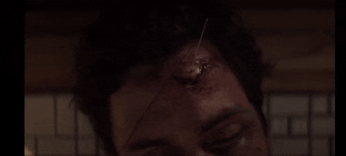 a close up of a man 's face with a stitch in his forehead .