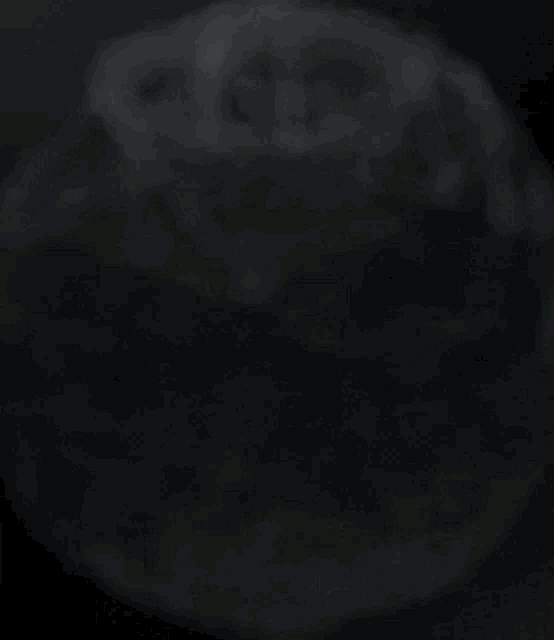 a bunch of black balls with a yellow glowing ball in the middle